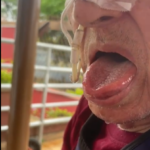 babão