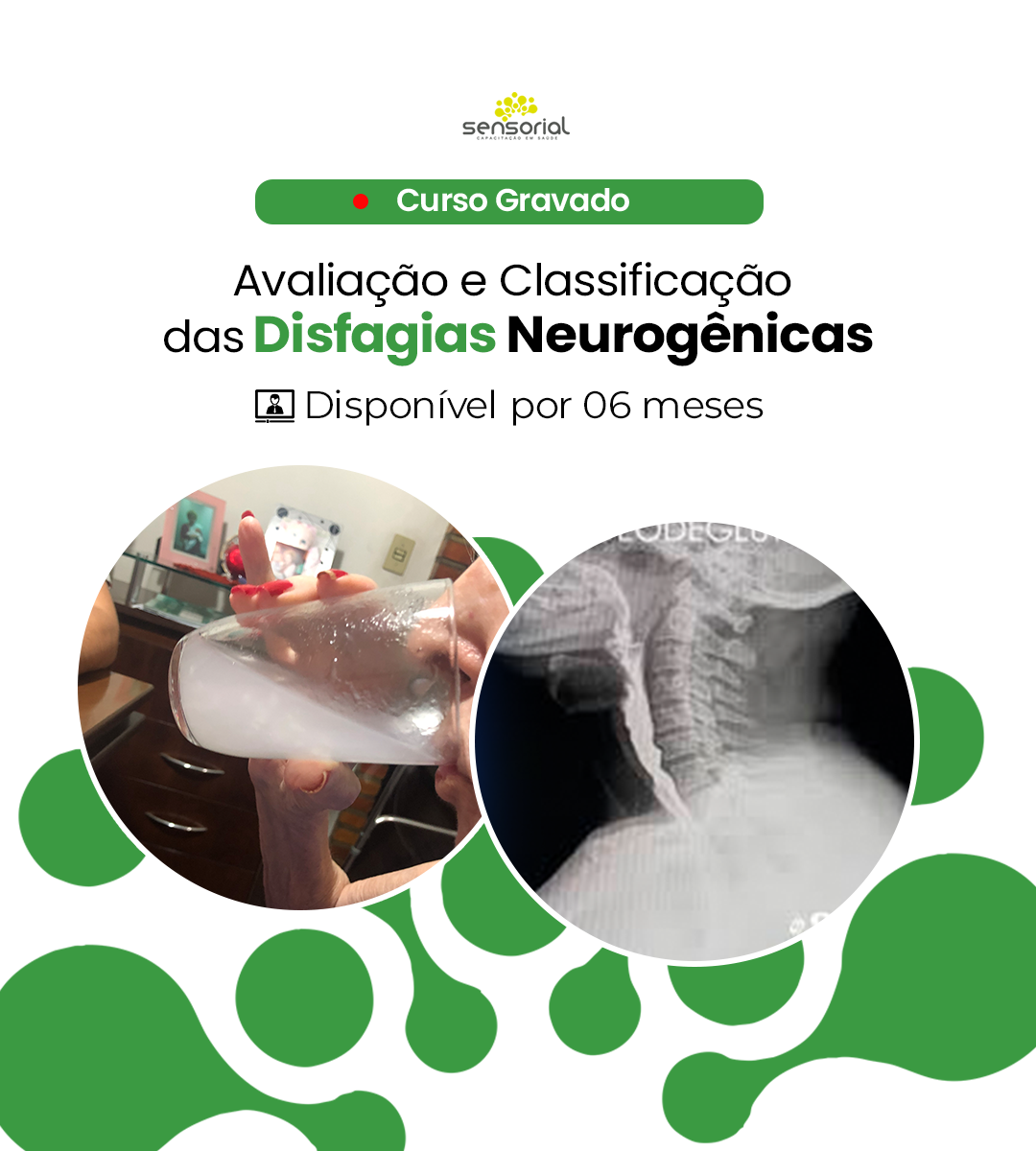 Avaliação Disfagia
