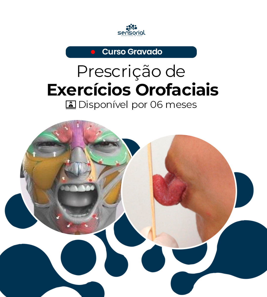 Prescrição de exercícios